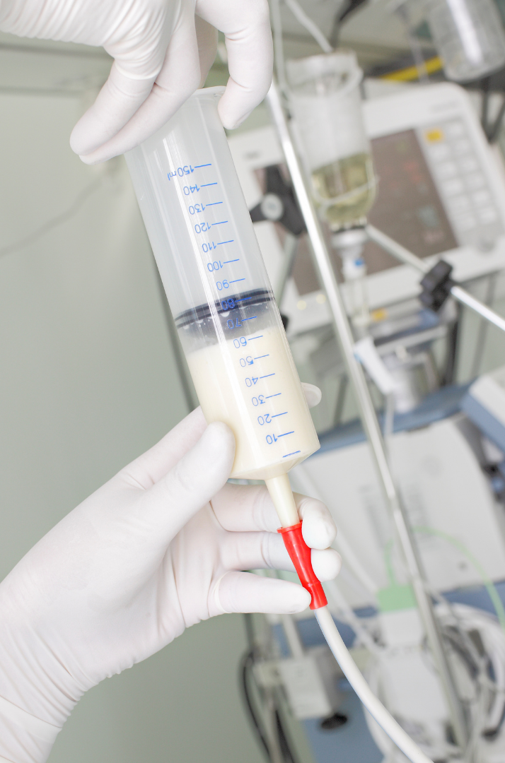 All You Need To Know About PEG Feeding