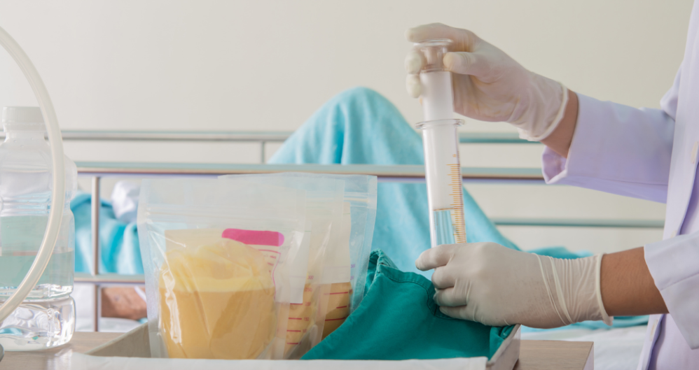 All You Need To Know About PEG Feeding